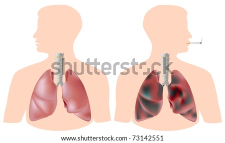 smoking lungs and healthy lungs. stock photo : Healthy lung