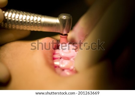Mouth of a man washing his dental plaque