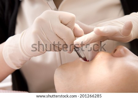 Mouth of man receiving care for gum