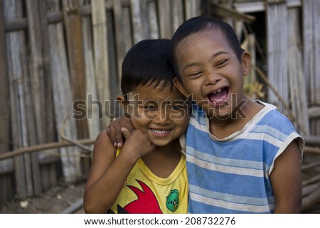 Bagan, Myanmar, March 2, 2014: In a little village, two children plays together. One of them has the down syndrome.  I don t see any difference   It s not diversity, it s friendship