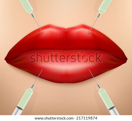 Injection of Treatment with botox or collagen. Lips and syringes.