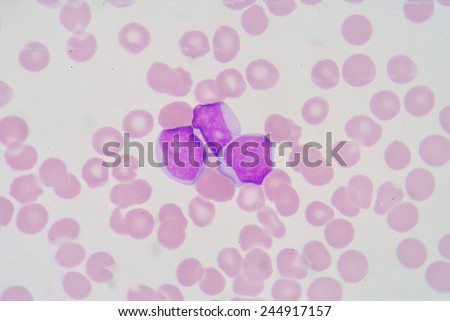 The myeloblast is a unipotent stem cell, which will differentiate into one of the effectors of the granulocyte series.
