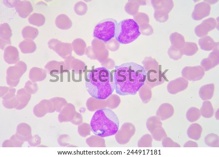 The myeloblast is a unipotent stem cell, which will differentiate into one of the effectors of the granulocyte series.