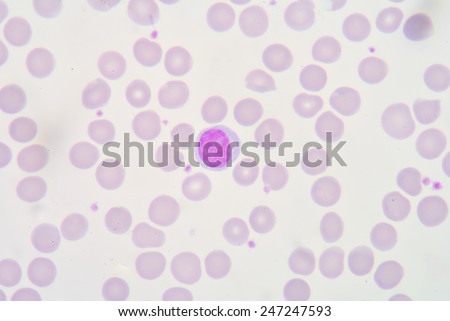 A lymphocyte is any of three subtypes of white blood cell in a vertebrate\'s immune system. All three are agranulocytes.