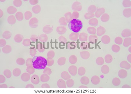 A blood smear is often used as a follow-up test to abnormal results on a complete blood count (CBC) to evaluate the different types of blood cells.