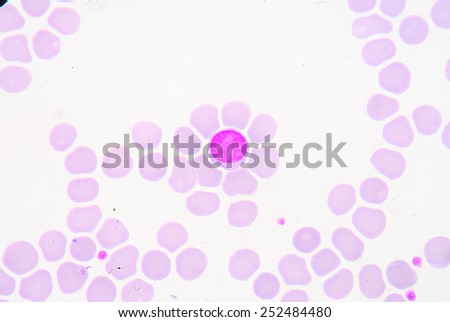 Normocytic red cell.