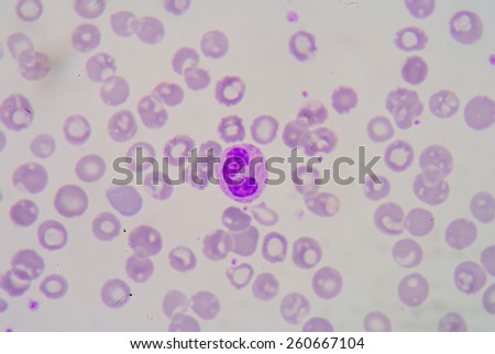 White blood cells of a human, photomicrograph panorama as seen under the microscope, 1000x zoom.