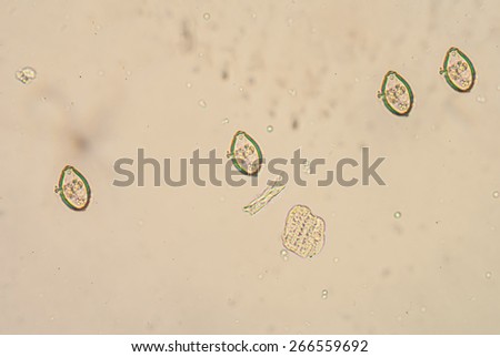 Opisthorchis viverrini, common name Southeast Asian liver fluke, is a trematode parasite.