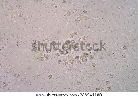 Bacteria in urine specimen under microscope 400x.