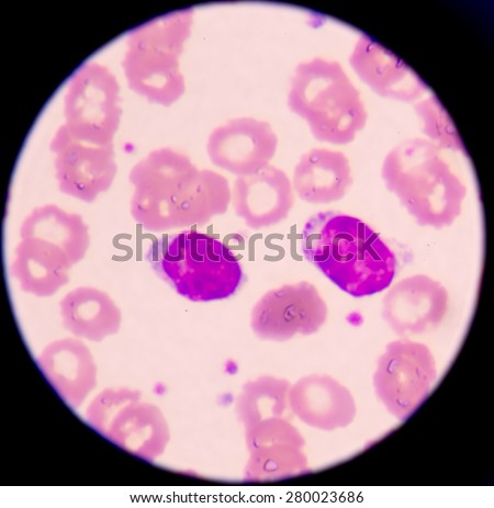 A blood smear is often used as a follow-up test to abnormal results on a complete blood count (CBC) to evaluate the different types of blood cells.