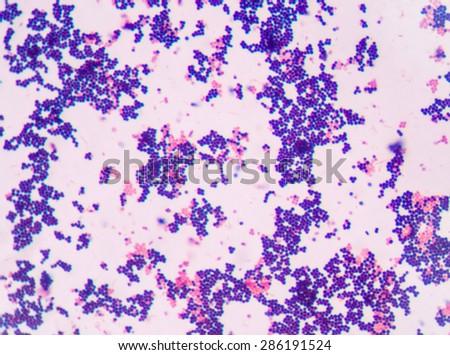 Gram staining, also called Gram\'s method, is a method of differentiating bacterial species into two large groups (Gram-positive and Gram-negative).