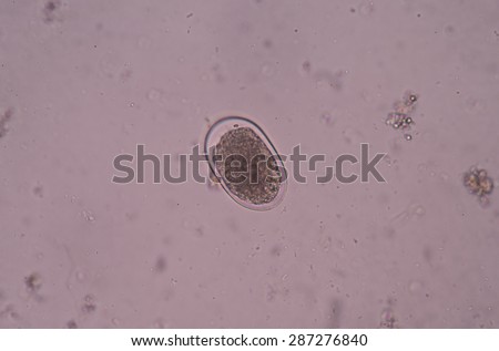 Hookworm is a parasitic nematode that lives in the small intestine of its host, which may be a mammal such as a dog, cat, or human.