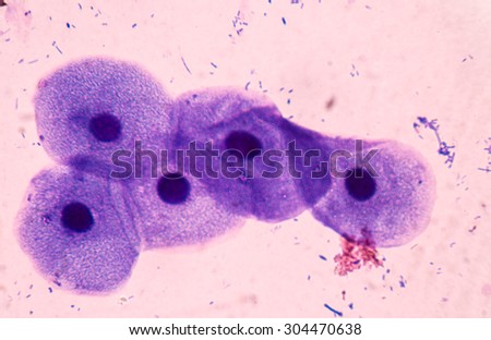 Gram staining, also called Gram\'s method, is a method of differe