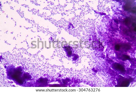 Gram staining, also called Gram's method, is a method of differentiating bacterial species into two large groups (Gram-positive and Gram-negative).