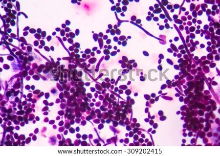 budding yeast cells with pseudohyphae in urine gram stain  fine with microscope.
