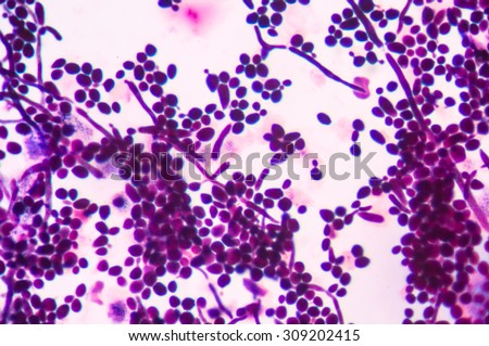 yeast budding gram stain pseudohyphae urine microscope cells fine candida shutterstock albicans under fungi fungus among