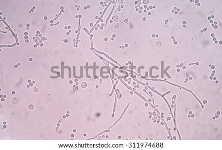 Branching budding yeast cells with pseudohyphae in urine sample fine with microscope.