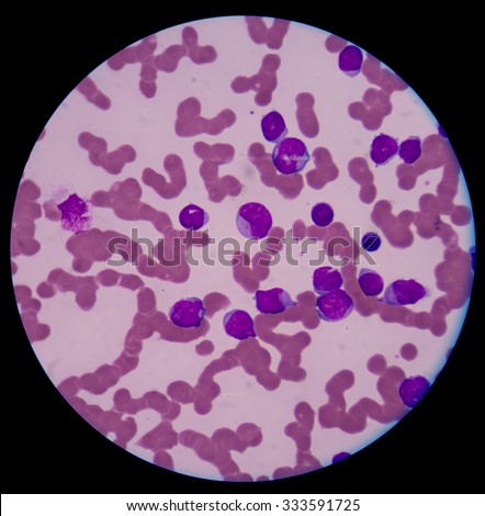 cells in bone marrow