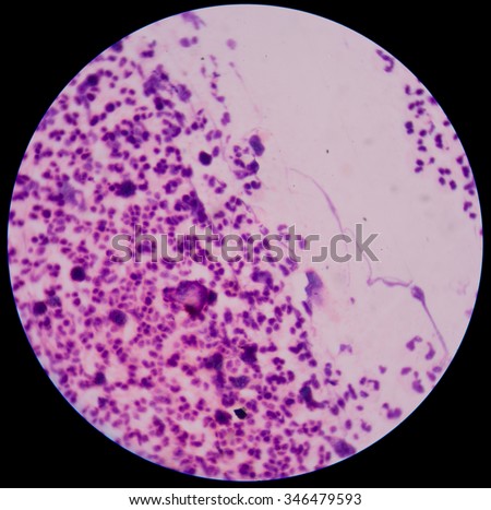 Chemical and cellular factors involved in the inflammatory response to tissue damage and repair.white blood cells clumping.
