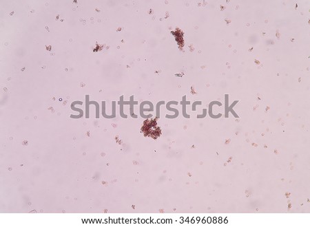 medical background bacteria&white blood cells in urine