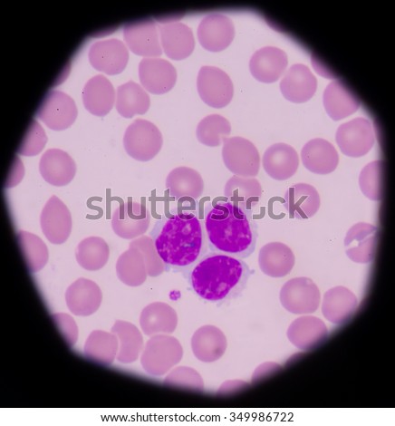 Lymphocyte. Immune cell. Antibody-producing cell. B-lymphocyte or T-lymphocyte in blood with red blood cells.Medical science background.