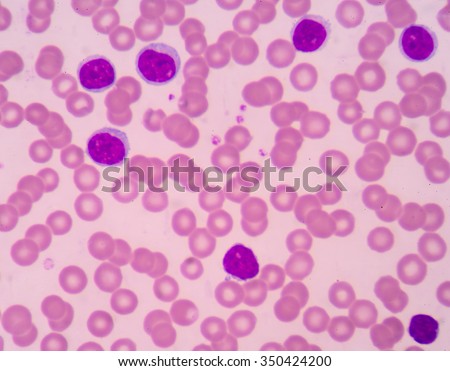 Lymphocyte. Immune cell. Antibody-producing cell. B-lymphocyte or T-lymphocyte in blood with red blood cells.Medical science background.