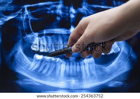 Dentist explaining x ray picture to patient on a digital monitor.