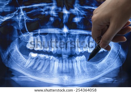 Dentist explaining x ray picture to patient on a digital monitor.
