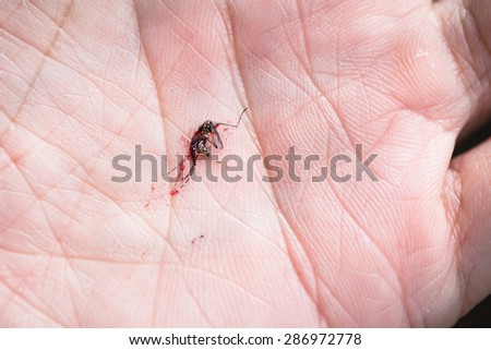 smashed mosquito full of blood on a palm, mosquito bites