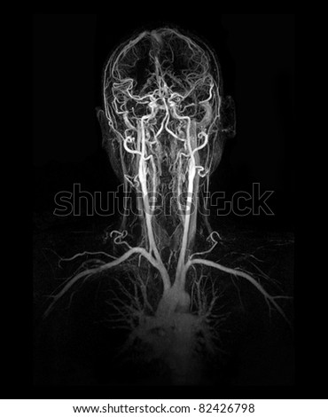 MRI image (MRA) show head and neck artery and vein