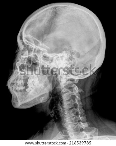 detail of neck and head x-ray image