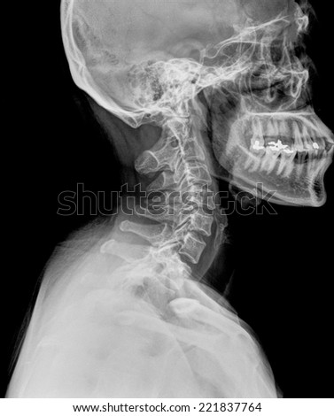 human neck radiography side view