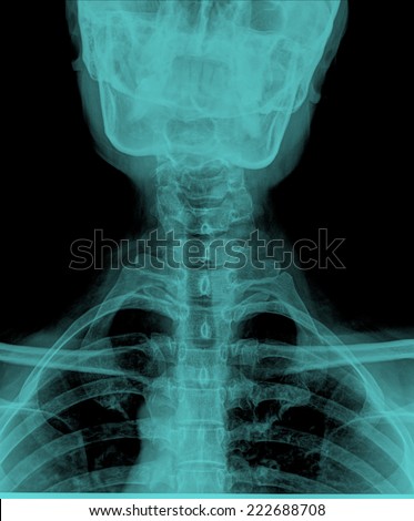 human neck radiography front view