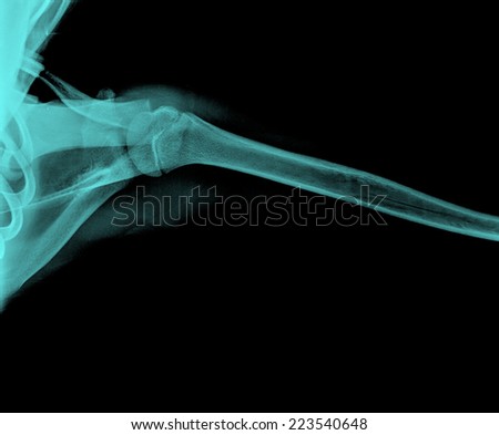 X-ray film of child shoulder fracture.