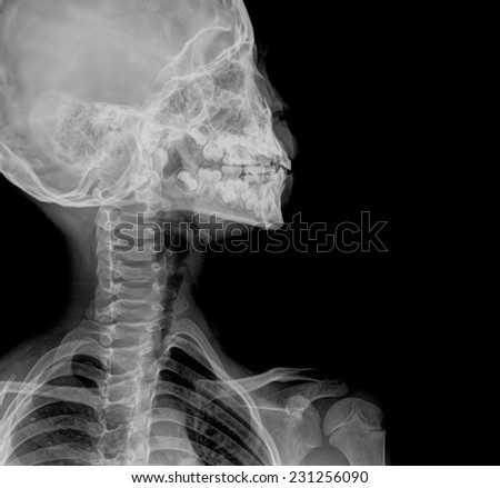 detail of neck x-ray image
