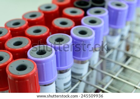 Close up medical test-tube with blood samples