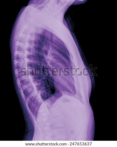 human thorax radiography side view , chest x-ray