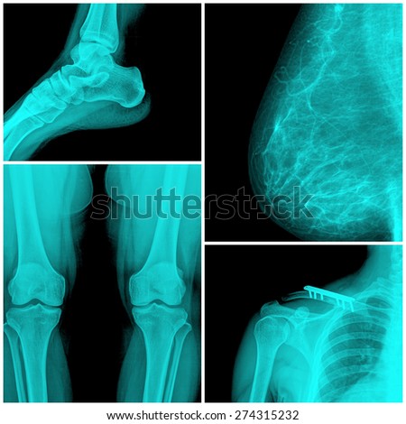 Collage of many X-rays. Very good quality