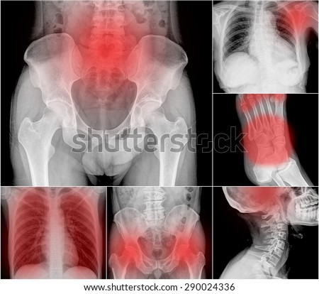 Collection X-ray multiple part of human , painful