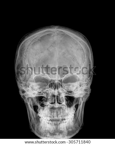 Film x-ray Skull lateral : show normal human's skull and cervical spine