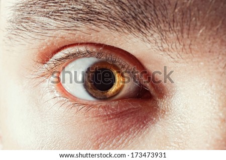scared male eye withÂ mydriatic pupil macro