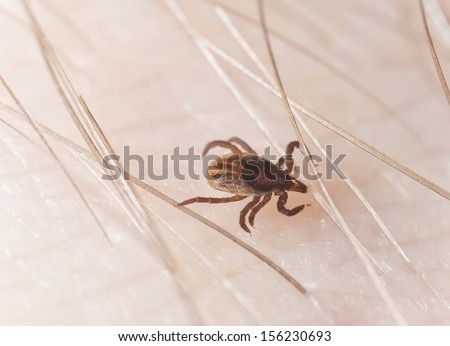 Tick crawling on human looking for a spot to bite, close-up with high magnification