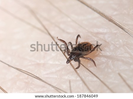 Tick crawling on human looking for a biting spot