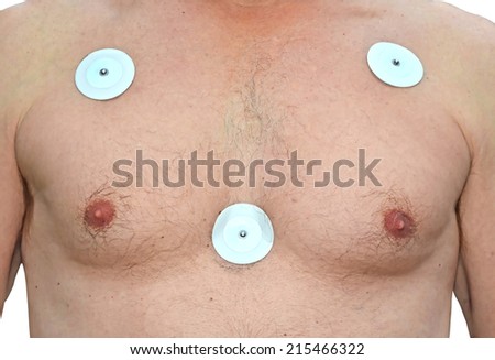 ECG electrode pads on the chest of a man, prior to a heart examination