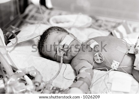 Premature Baby Boy born six and a half weeks early asleep attached to a ventilator and other emergency intervention in Neo Natal Intensive Care Unit