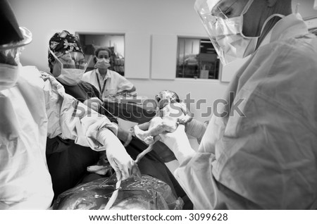 Delivery room images of birth of baby boy by emergency Caesarean