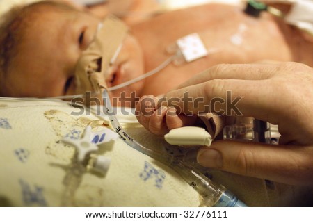 Premature baby boy delivered by Caesarean section, in Neo Natal Intensive Care Ward at Hospital