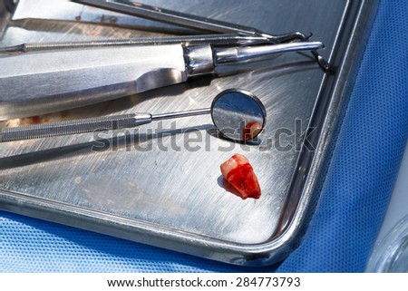 Dental Tools for Tooth Extraction and Tooth. Medical Background.