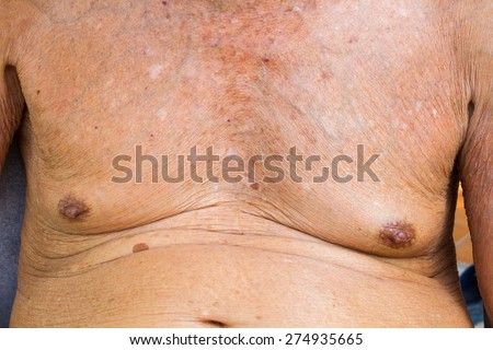 closeup old man chest with texture of wrinkle skin