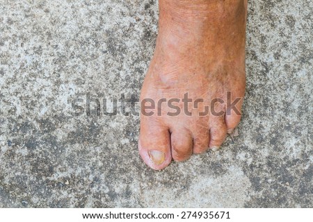 Top View Bare Foot of old man on Cement Floor Background. Copyspace on the left